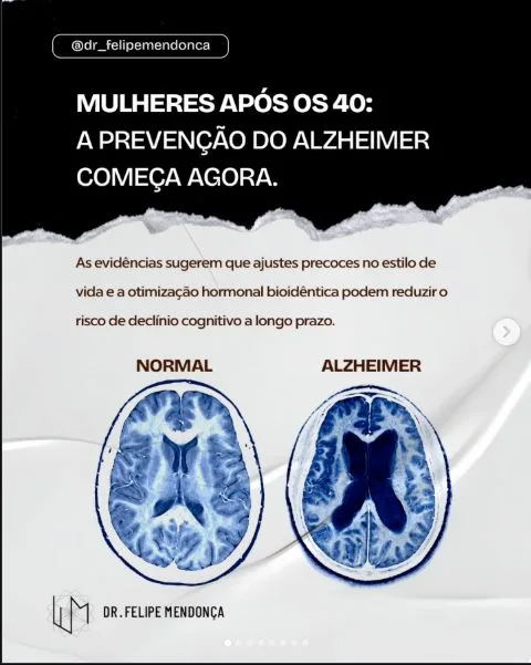 Publicação 7 — Instagram do Dr. Felipe Mendonça